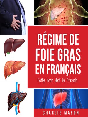 cover image of Régime de foie gras En français/ Fatty liver diet In French